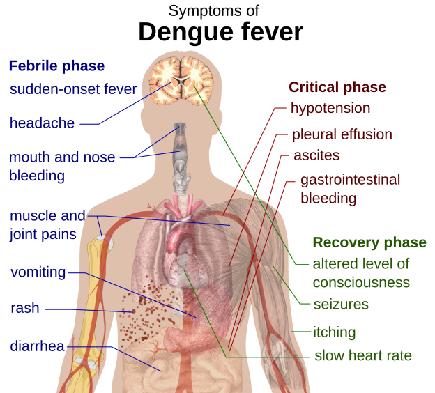 gejala demam dengue (foto sumber: simple.wikipedia.org)